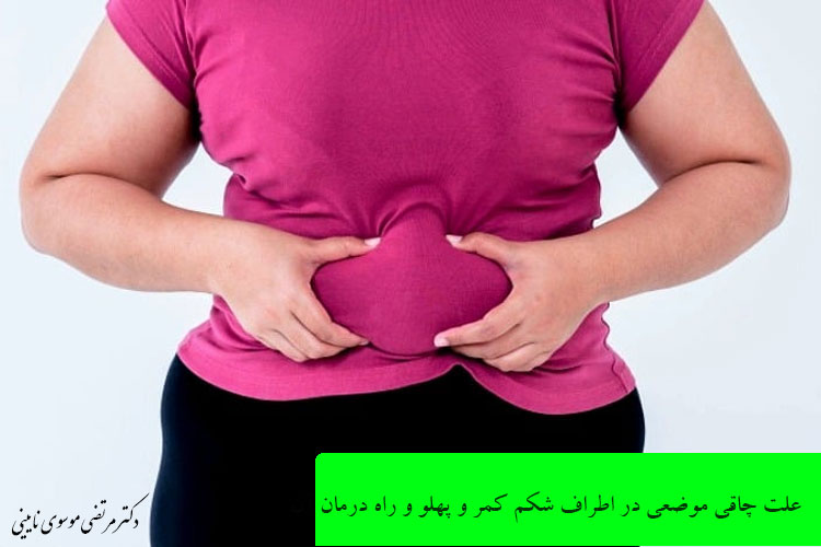 علت چاقی موضعی در اطراف شکم کمر و پهلو و راه درمان آن