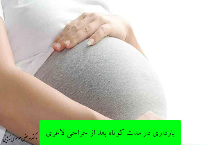بارداری در مدت کوتاه بعد از جراحی لاغری