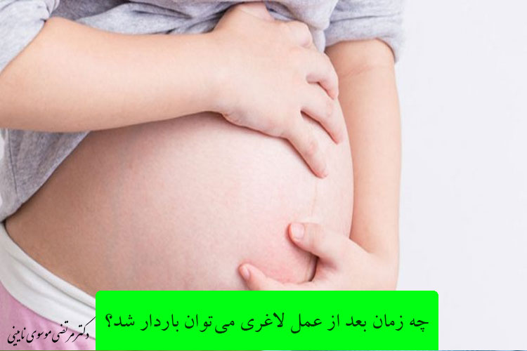 چه زمان بعد از عمل لاغری می‌توان باردار شد؟