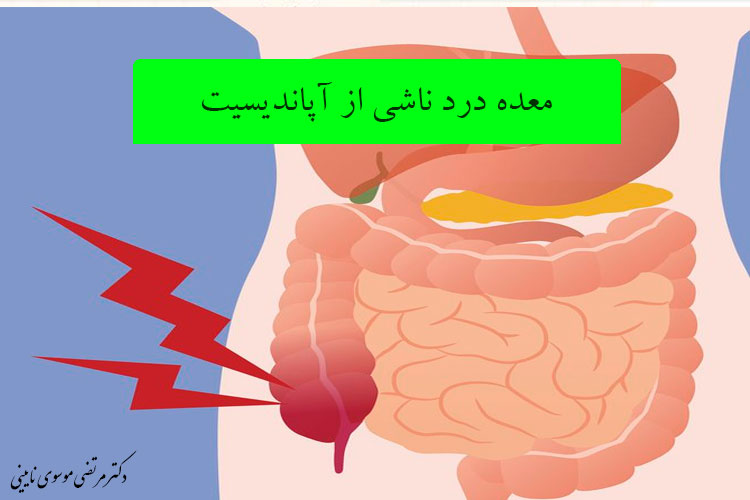 معده درد ناشی از آپاندیسیت