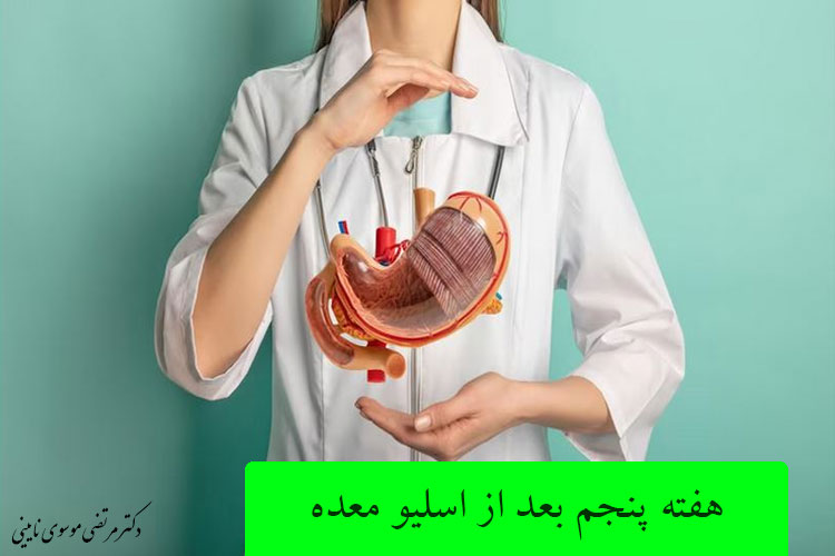 هفته پنجم بعد از اسلیو معده